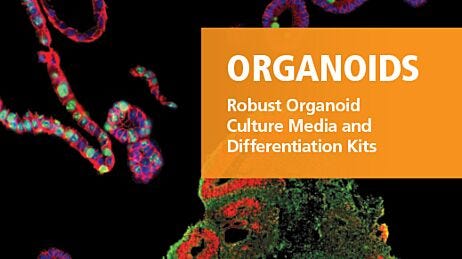 Organoids