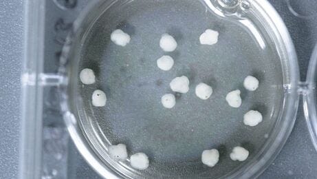 Neural Organoid Culture