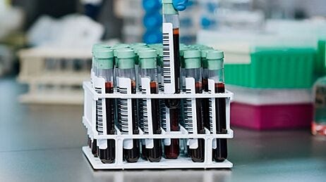 How to Isolate Specific Cell Subsets by Immunodensity Cell Separation