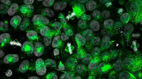 CRISPR-Cas9 Gene Editing of Cerebral Organoids to Model Microcephaly