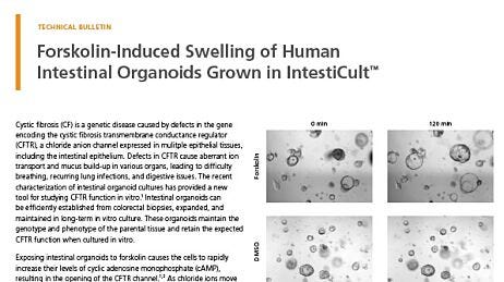 Forskolin-Induced Swelling of Human Intestinal Organoids Grown in IntestiCult™