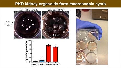 Re-Creating Disease with Kidney Organoids and CRISPR