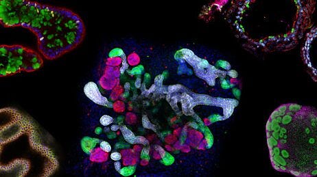 The Predictive Power of Organoids in Drug Discovery