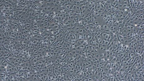 Neural Induction of hPSCs Using the Monolayer Method
