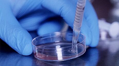 Dissociation of Mouse Solid Tumors into Single-Cell Suspension