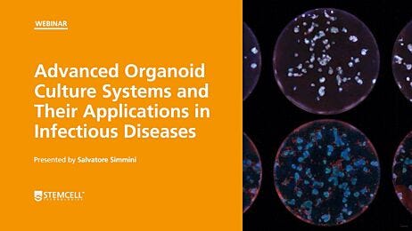 Advanced Organoid Culture Systems and Their Applications in Infectious Diseases