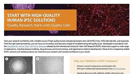 从高质量人类诱导多能干细胞（iPSC）解决方案开始