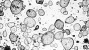 Toxicity Testing for Drug Development Using Human Intestinal Organoids and IntestiCult™