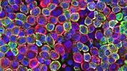 How to Generate Alveolar Monolayers from ATII Organoids