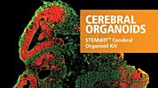 STEMdiff™ Cerebral Organoid Kit
