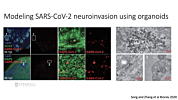 Exploring the Impact of SARS-CoV-2 Infection on the Central Nervous System