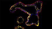 Performing Immunocytochemical Staining of Epithelial Organoids