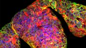 CRISPR-Cas9 Genome Editing of Human Liver Organoids