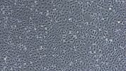 Neural Induction of hPSCs Using the Monolayer Method