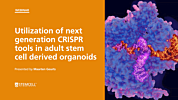 Utilization of Next Generation CRISPR Tools in Adult Stem Cell Derived Organoids