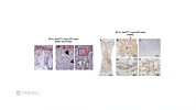 Bone Marrow Skeletal Progenitors and Bone Diseases