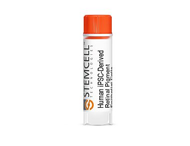 Human iPSC-Derived Retinal Pigment Epithelial Cells