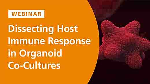 Dissecting the Innate Immune Response in Human Intestinal Organoid Models