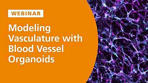 Modeling the Structural and Functional Features of Blood Vasculature with Blood Vessel Organoids