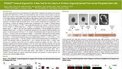 STEMdiff Cerebral Organoid Kit: A New Tool for the Culture of 3D Brain Organoids Derived from Human Pluripotent Stem Cells