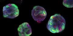 How to Generate hPSC-Derived 3D Kidney Organoids Using STEMdiff™
