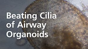 Beating Cilia of Airway Organoids Grown in PneumaCult™