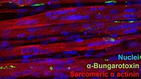 3D Modeling of Skeletal Muscle for In Vitro Functional Assaying