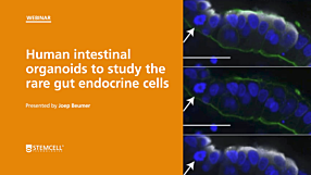 Human Intestinal Organoids to Study the Rare Gut Endocrine Cells