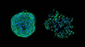 Drug Screening and Phenotypic Analysis in a Microwell-based 3D Cell Culture System