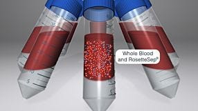 RosetteSep™ for HLA Analysis