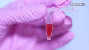 HetaSep™: Red Blood Cell Depletion for Small Volume Samples