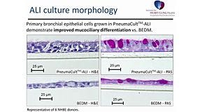 PneumaCult™-ALI: An Improved Medium Formulation for the Differentiation of Human Bronchial Epithelial Cells