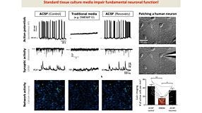 The Road to Functional Human Neuronal Circuits in Vitro