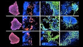 Modeling Genetic Epilepsies with Induced Pluripotent Stem Cells