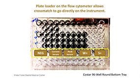 Considerations to Streamline the Flow Cytometry Crossmatch (FCXM) Assay