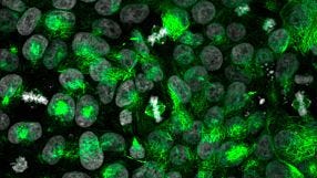 CRISPR-Cas9 Gene Editing of Cerebral Organoids to Model Microcephaly