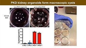 Re-Creating Disease with Kidney Organoids and CRISPR