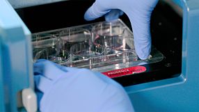 How to Standardize Hematopoietic Colony Counting with STEMvision™