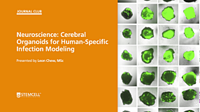 STEMCELL Journal Club: Cerebral Organoids for Human-Specific Infection Modeling