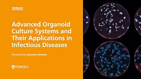 Advanced Organoid Culture Systems and Their Applications in Infectious Diseases
