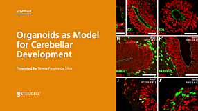 Virtual STEMCELL Seminar: Organoids as Models for Cerebellar Development