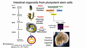 Modeling Human Gastrointestinal Development and Disease Using Pluripotent Stem Cells