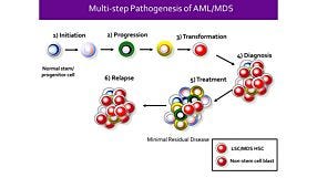 Identification of Stem Cells in Myeloid Malignancies - Opportunities for Discovery and Translation