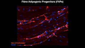 The Secret In Vivo Life of "Mesenchymal Stem Cells"