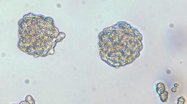 Culture Mammospheres and Tumorspheres with the MammoCult™ Medium