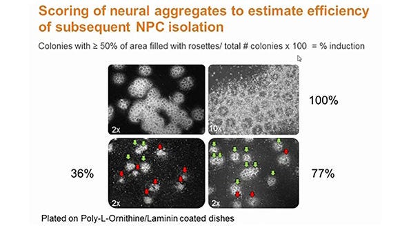 Neural Stem Cell Culture Systems - Neurosphere vs. Adherent Monolayer Culture