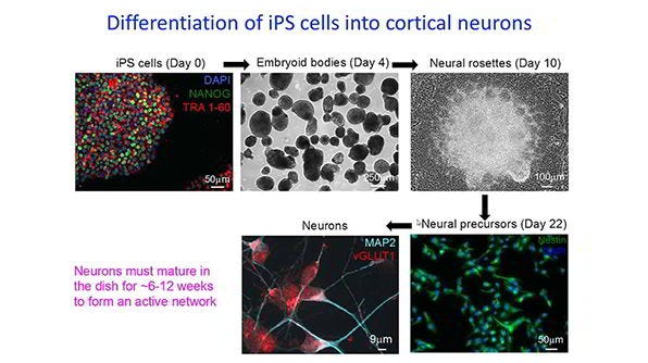 Neuronal Phenotyping of an iPS Cell Model of Rett Syndrome