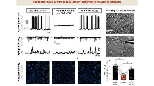 The Road to Functional Human Neuronal Circuits in Vitro 