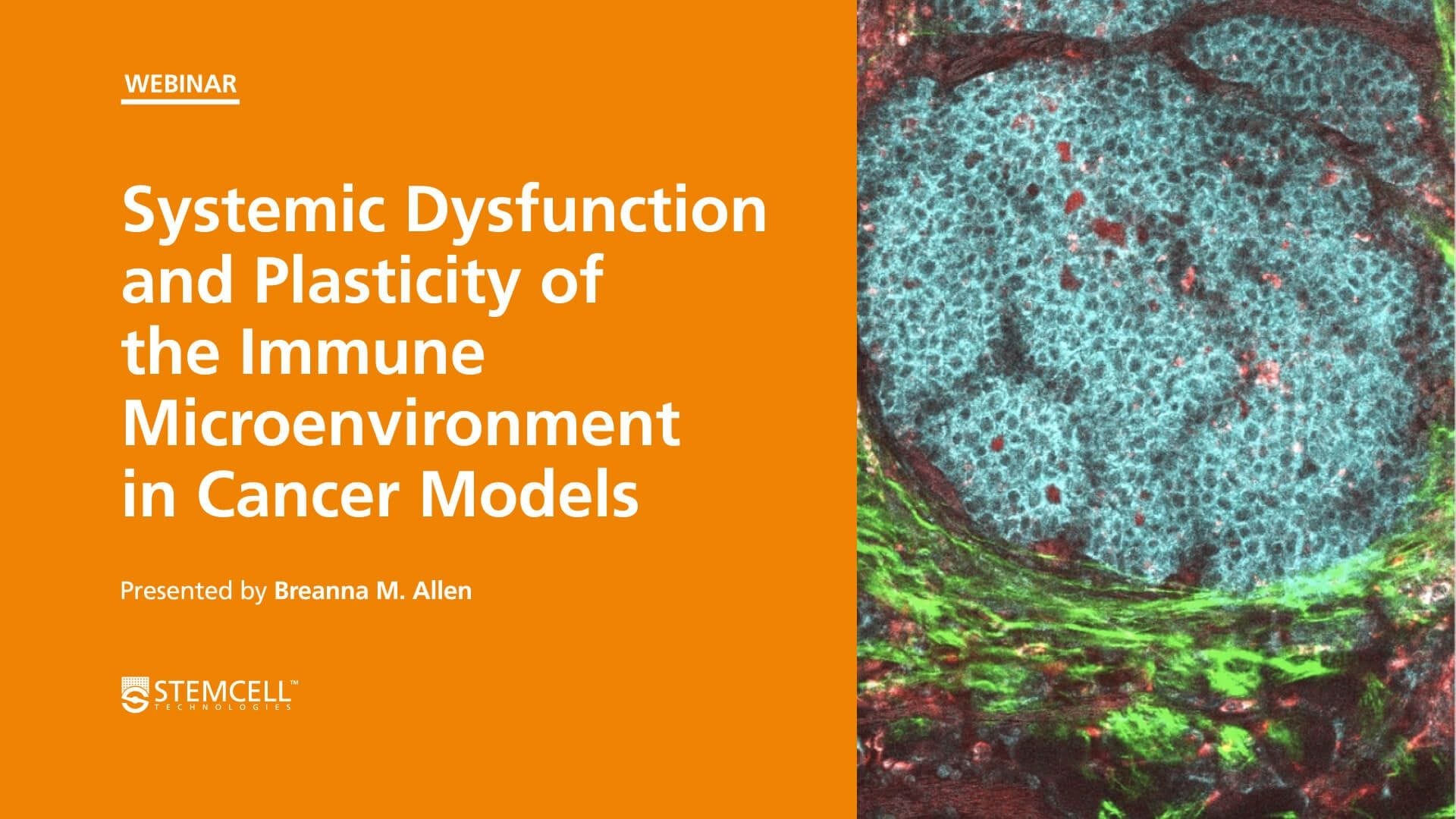 Systemic Dysfunction and Plasticity of the Immune Macroenvironment in Cancer Models