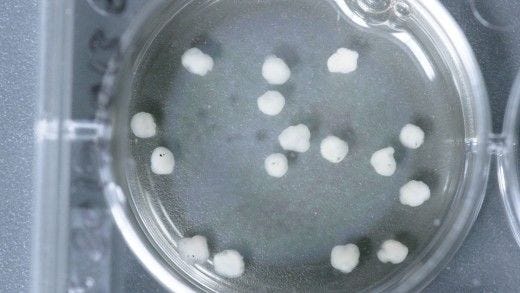 Neural Organoid Culture